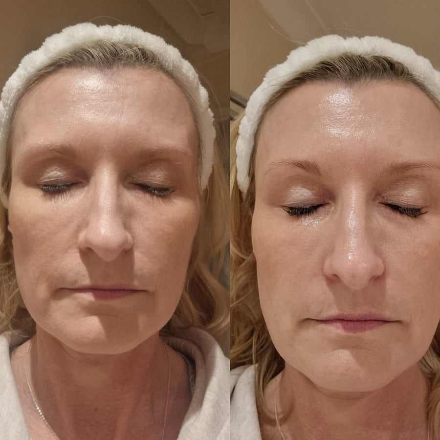 Power Peptide Peel
